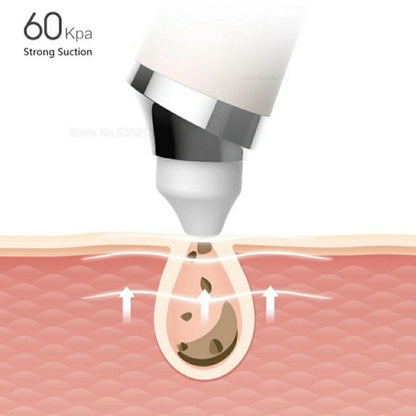 Visual Blackhead Remover